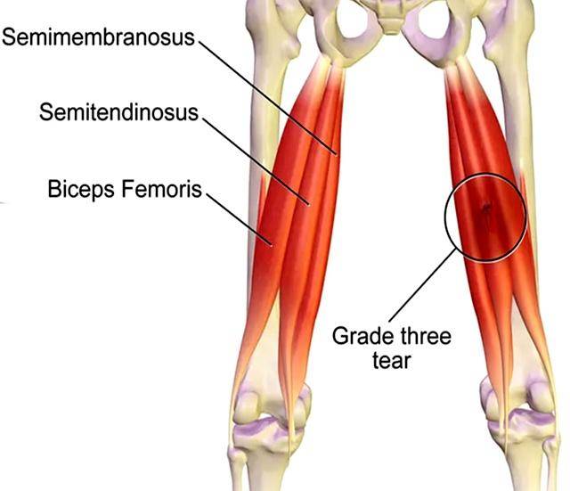 大洋洲篮球支持者翘首期待新赛季巅峰对决的简单介绍